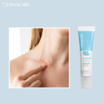 DERMACARE-kelo-treat-15-m-alpha-l